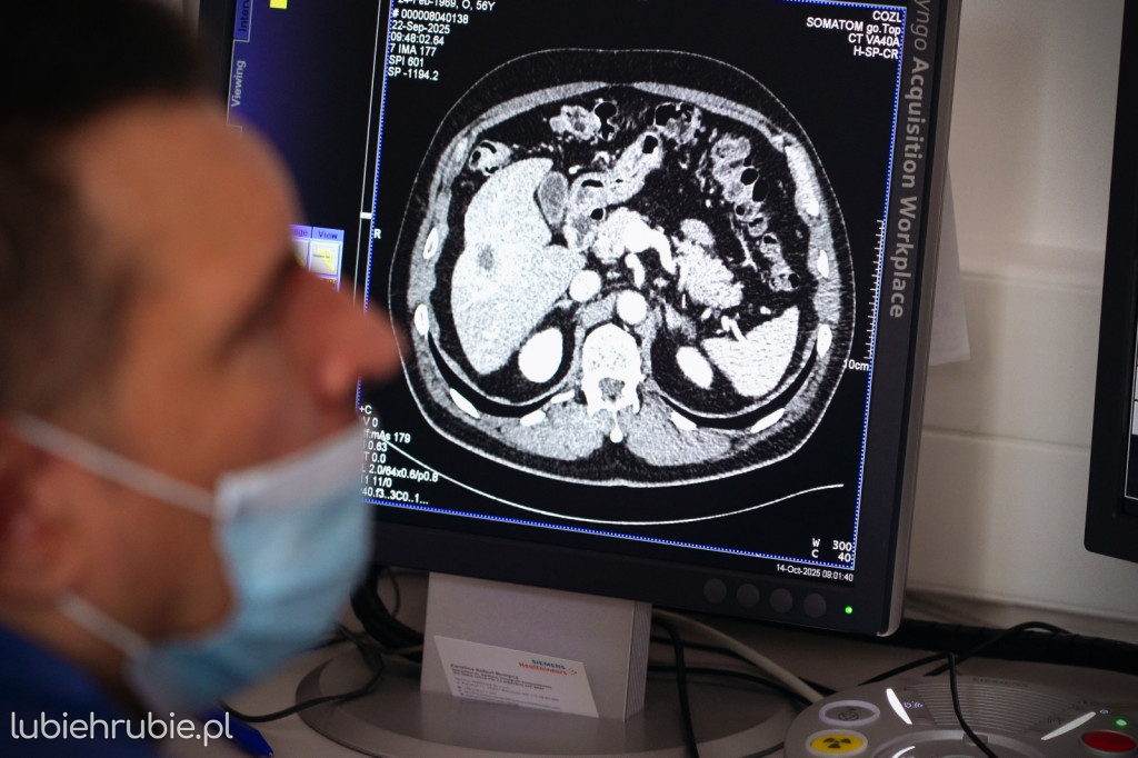 Lubelska onkologia z jedną z najnowocześniejszych pracowni brachyterapii w Polsce