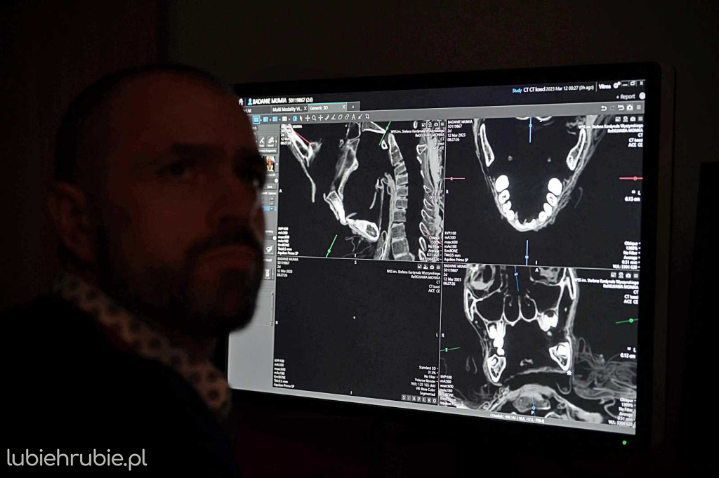 Egipska mumia pod lupą radiologów z Lublina